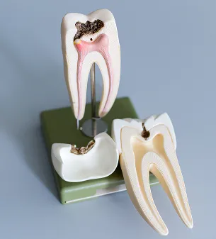 Emergency Dental Care